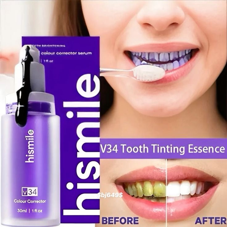 Hismile Teeth Whitening